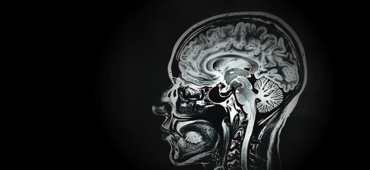 The Role of the Craniocervical Junction in Neurological and Neurodegenerative Conditions